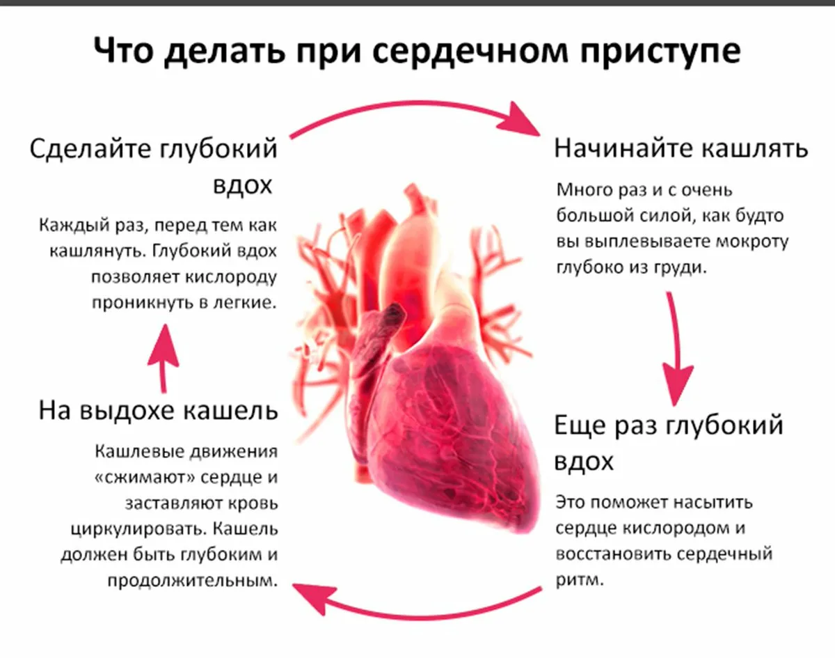 Может ли остановиться сердце. Что сделать КСЛИ уолит сеплцею. Если болит сердце. Что делать потсердечном приступе. Что делать если болит сердце.